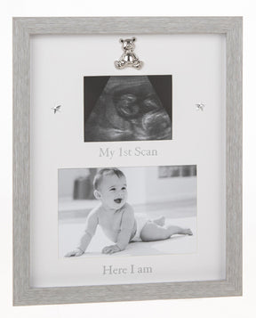 My 1st Scan and Here I am Photo Frame 